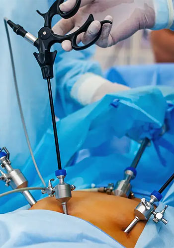 Laparoscopic Kidney Surgery